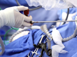 IMSS realiza exitosa cirugía robótica contra cáncer de endometrio