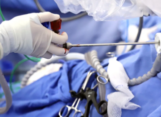 IMSS realiza exitosa cirugía robótica contra cáncer de endometrio